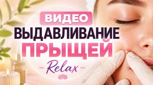 ВЫДАВЛИВАНИЕ ПРЫЩЕЙ. ЧАСТЬ #1113