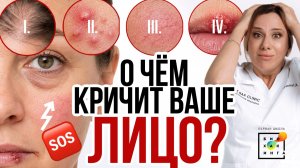 Болезни налицо. 15 признаков, которые лучше не игнорировать! #пшб #иринабаранова