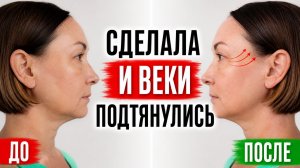90% упускают это: скрытая причина нависших век
