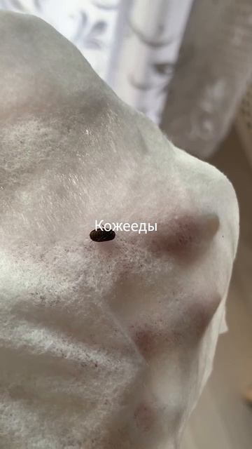 Кожееды.Дезинсекция в Москве и Московской области.