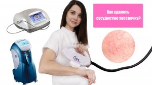 Сосудистая звездочка на лице. Как убрать?