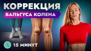 Комплекс от динамического вальгуса колен