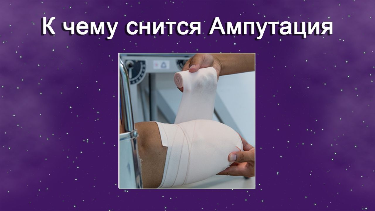 К чему снится Ампутация - толкование сна