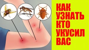 Укус клеща или блохи? Что нужно делать срочно после укуса