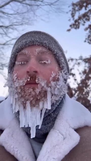 🔥😂 ЛИЦО В СОСУЛЬКАХ 🤣 (смешное видео, юмор, приколы, поржать, ржака, ржач, смешное 2026)
