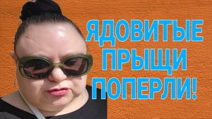 ЯДОВИТЫЕ ПРЫЩИ ПОПЁРЛИ! ОЛЬГА ИЗ ЗАУРАЛЬЯ. ОБЗОР.
