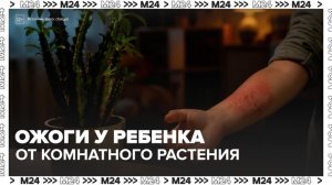 В Москве ребенок получил ожоги от комнатного растения - Москва 24