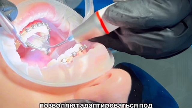 GBT протокол  стоматологической клинике Парадигма