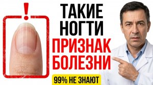 Ваши ногти предупреждают о болезнях — 99% людей это игнорируют