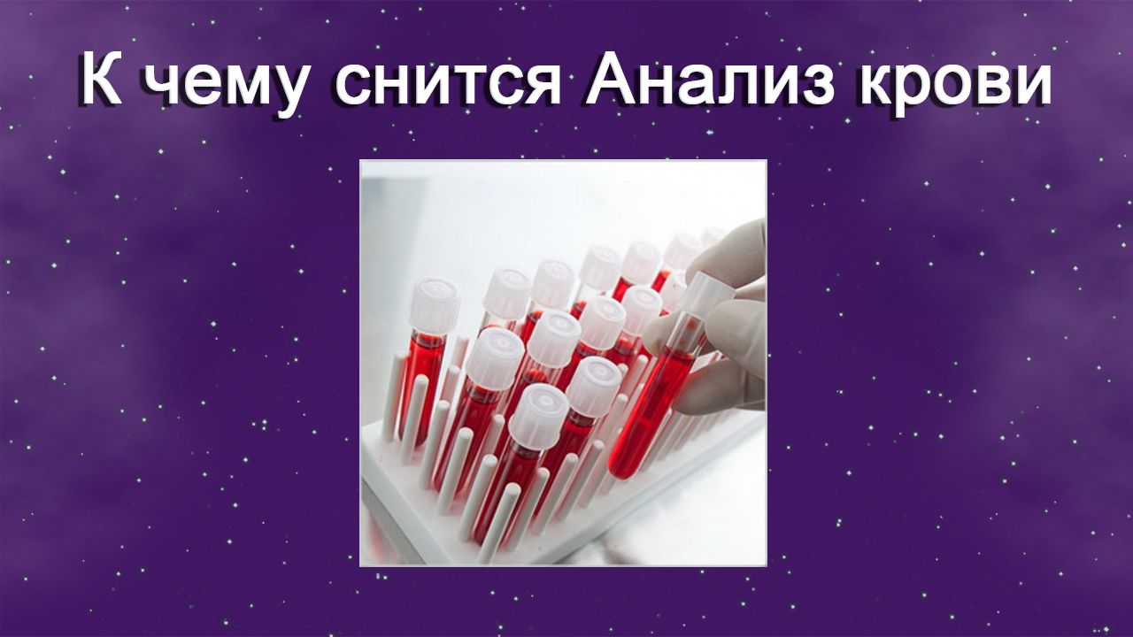 К чему снится Анализ крови - толкование сна