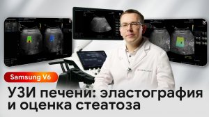 УЗИ печени на Samsung V6: эластография и оценка стеатоза (жирового гепатоза)