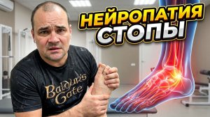 Моя диабетическая Нейропатия. Как справился с болями, коликами и жжением в стопах.