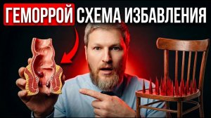 ГЕМОРРОЙ: как лечить в домашних условиях и УБРАТЬ НАВСЕГДА