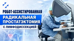 Робот-ассистированная радикальная простатэктомия с лимфодиссекцией
