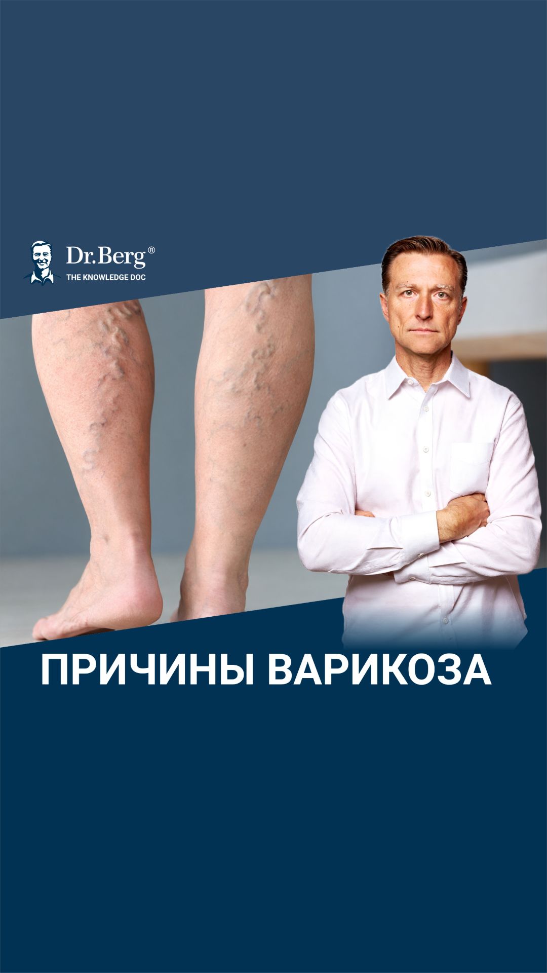 Именно ЭТО вызывает варикоз на ногах🙌