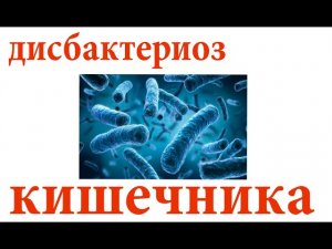 Как восстановить микрофлору кишечника. Лечение дисбактериоза