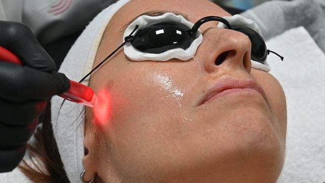 Jet Peel Джет Пил с одновременной хромотерапией LED-опция
