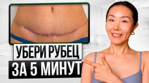 Эти УПРАЖНЕНИЯ УБЕРУТ РУБЕЦ — Как избавиться от рубца после кесарева?