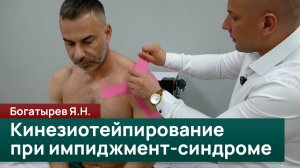 Кинезиотейпирование при импиджмент-синдроме: разгрузка плеча и декомпрессия. Богатырев Я. Н.