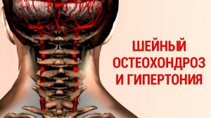 90% Населения страдает от шейного остеохондроза. Останови этот круг
