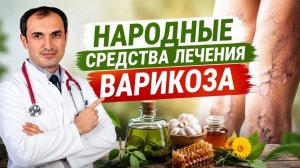 Народные средства лечения варикоза. Флеболог Москва.