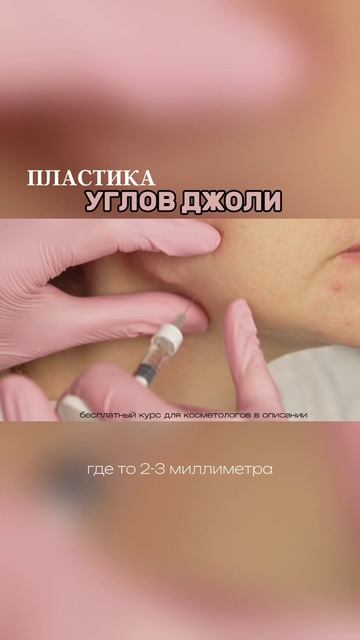 Пластика углов Джоли