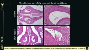 Histological changes and brain drainage in a mouse model of obstructive sleep apnea