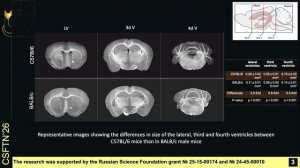 Differences in brain drainage and cognitive function between BALB/c and C57Bl/6 mice