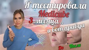 Стоит ли покупать Medicube? Честный результат через 3 месяца. Реальный опыт и фото ДО/ПОСЛЕ.