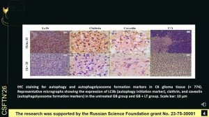 Non-invasive phototherapy of glioblastoma in rats