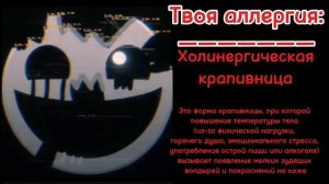 Твоя аллергия/ Жуткие гд лица