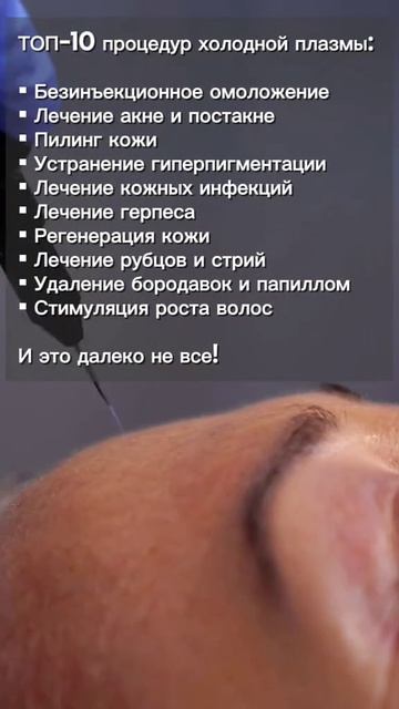 Премиальный аппарат холодной плазмы SUPERAN PLAZOBEST
