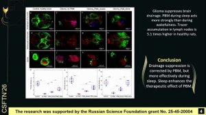 Effect of photobiomodulation during sleep and wakefulness on glioma growth and ...