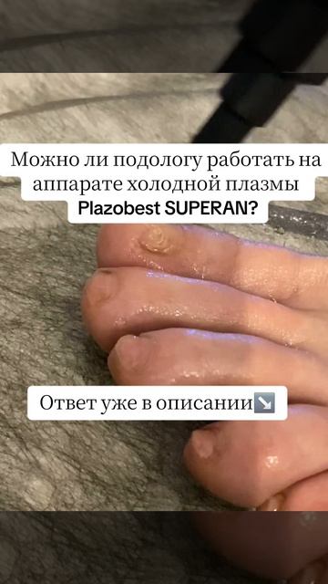 Можно ли подологу работать на аппарате холодной плазмы Plazobest SUPERAN?