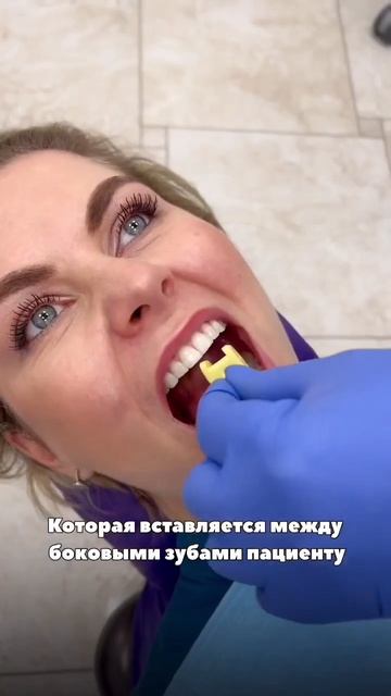 Instagram:  @dr.anastasiavyshlova  #стоматологмосква #стоматологиямосква #стоматология