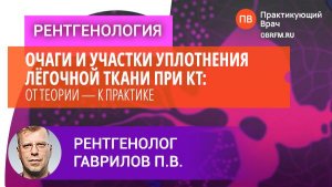 Гаврилов П.В.: Очаги и участки уплотнения лёгочной ткани при компьютерной томографии
