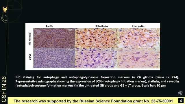 Non-invasive Phototherapy Of Glioblastoma In Rats