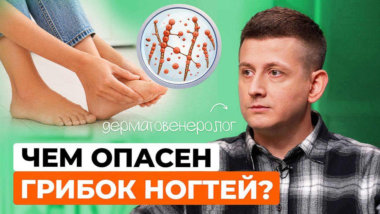 Грибок ногтей: как вылечить и не допустить рецидива