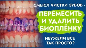 Нет кариеса и пародонтита - все очень просто!