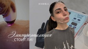 ЭЛЕКТРОЭПИЛЯЦИЯ // МОЙ ПУТЬ В 7 ЛЕТ