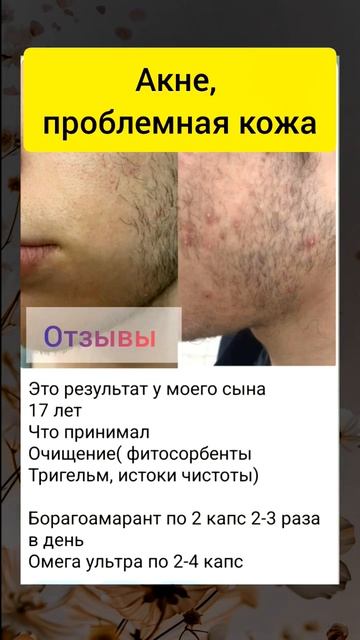 Проблемная кожа