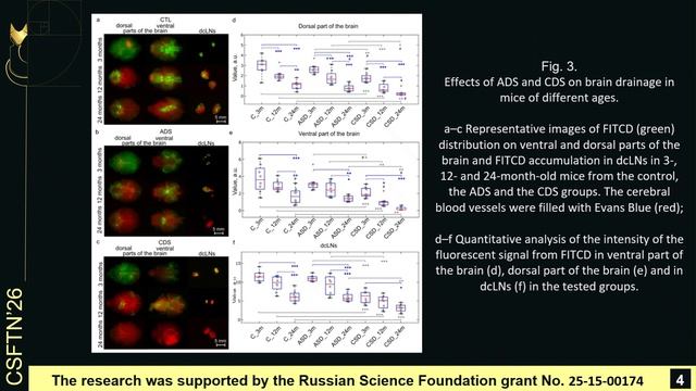 Sleep Deficiency Exacerbates Age-related Decline In Brain Drainage And Clearance In Mice