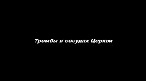 Тромбы в сосудах Церкви