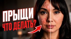 Прыщи на лице: что делать? Какие средства реально работают | MESOMATRIX