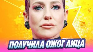 Юлия Барановская показала крупным планом обезображенное лицо