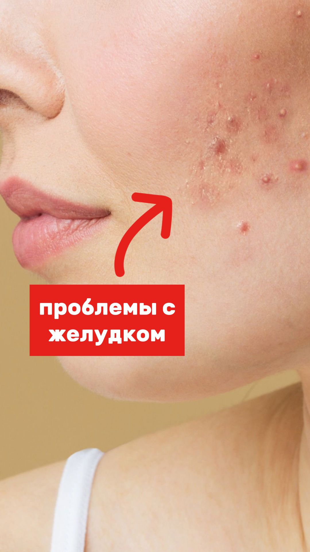 Почему прыщ появляется на одном и том же месте? Карта прыщей