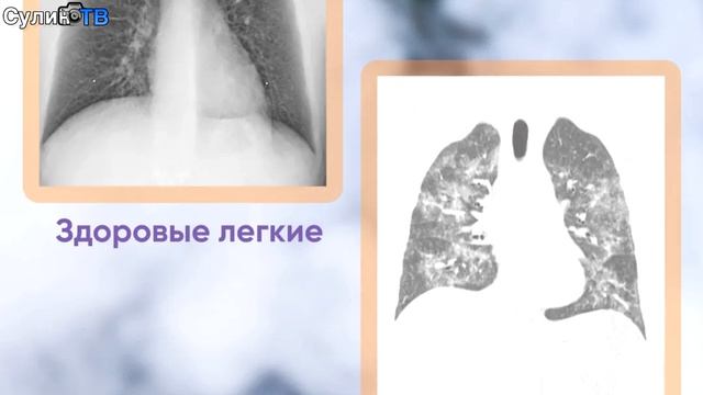 Быстрые новости 19 05 25