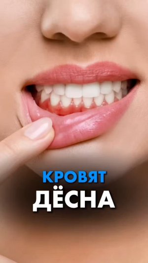 КРОВЯТ ДЕСНА