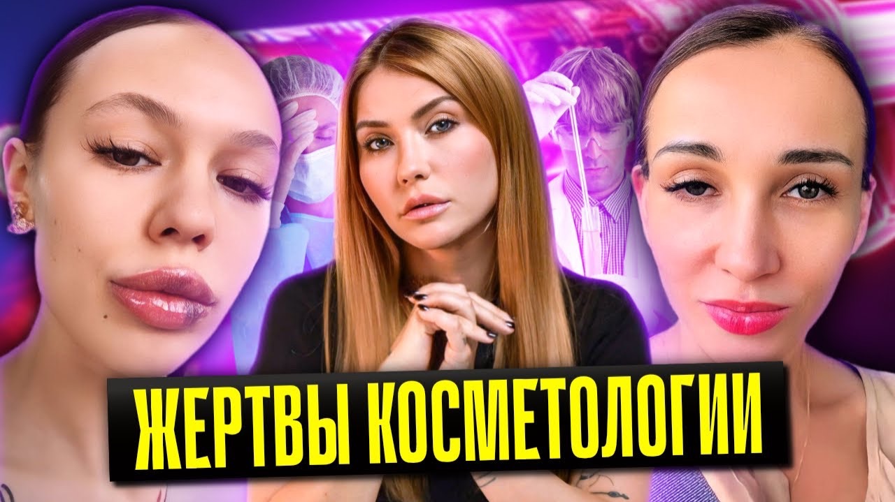 Жертвы косметологии | Инстасамка филлер | Анфиса Чехова ботокс