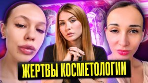 Жертвы косметологии | Инстасамка филлер | Анфиса Чехова ботокс